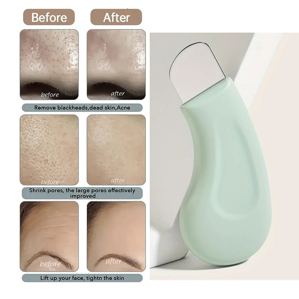 Pore Cleaner & Blackhead Remover Tool
