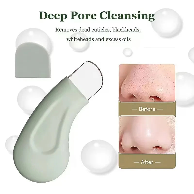 Pore Cleaner & Blackhead Remover Tool